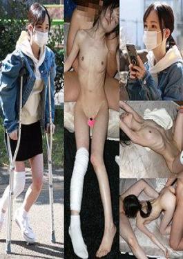 Mosaic 726ANKK-091 （仮）暗黒091さん